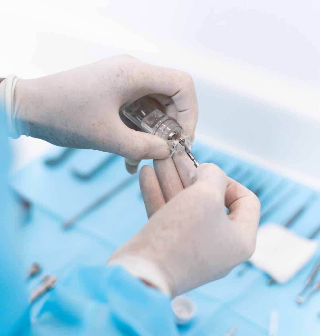 Implantes Dentários 2