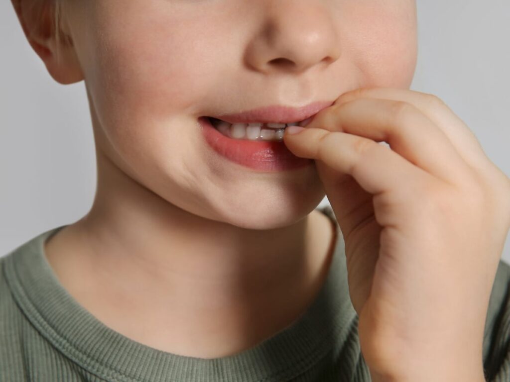 dentista para criança