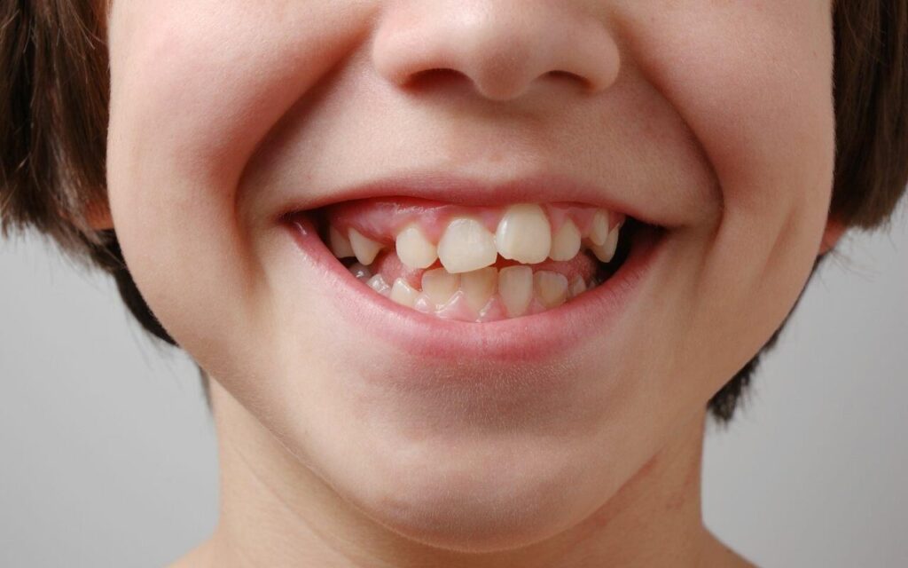 odontopediatria